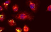 GPU powered cancer detection
