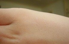 skinskin
