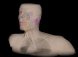 Head and neck model volumetric rendering with critical structures, by UCLA's John Neylon.