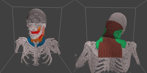 GPU-based high-resolution multi-level biomedical skeletal anatomy with critical structures undergoing deformation due to head rotations by UCLA's John Neylon.