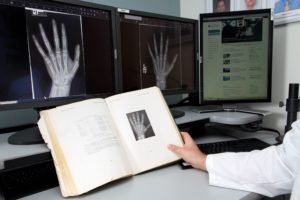 Radiologists calculating children's bone age must use a textbook published 75 years ago to compare with digitized x-rays of a child's hand.