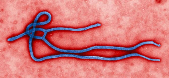 エボラ ウィルスの写真