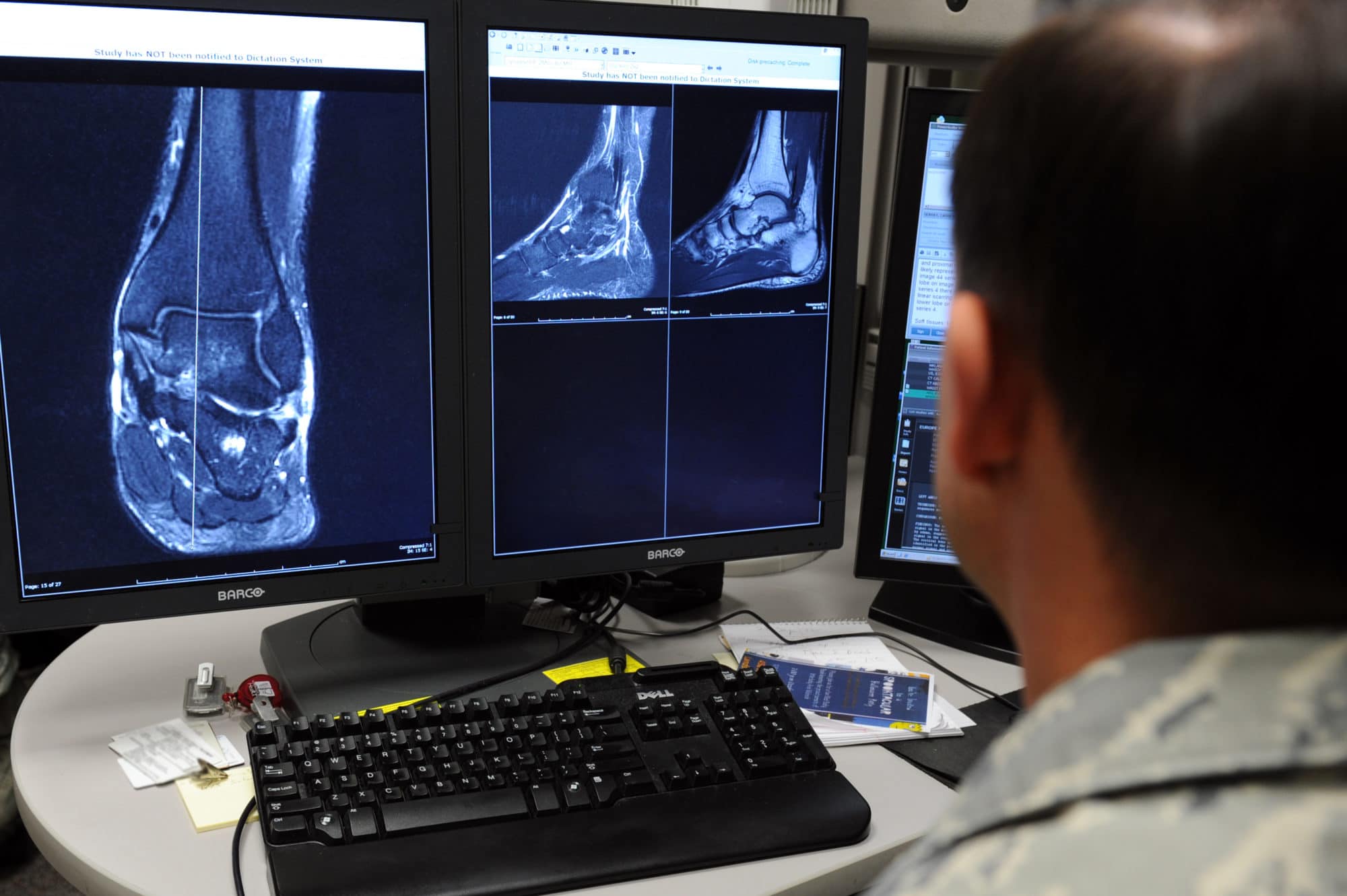 AI in healthcare is most commonly used to read X-rays, MRIs and other medical images.