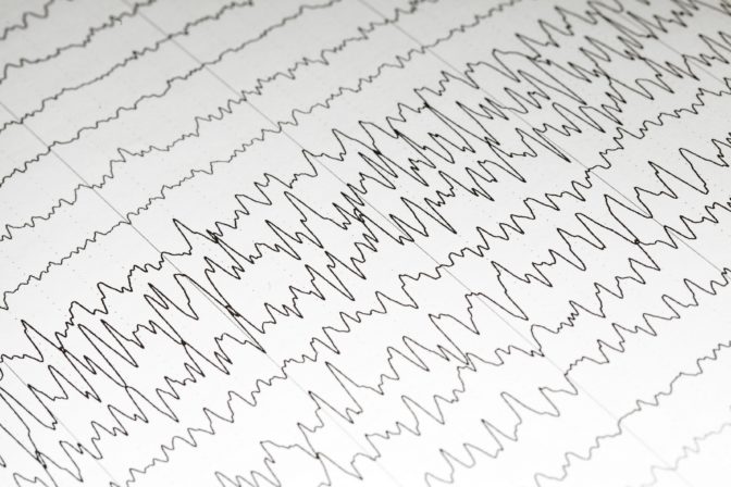 To help people with epilepsy. researchers used patients' EEG readings to train a deep learning model to predict seizures.