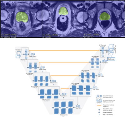 schematic representation of fully convolutional neural network