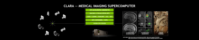 Project Clara: NVIDIA Supercomputing Platform Redefines Medical Imaging