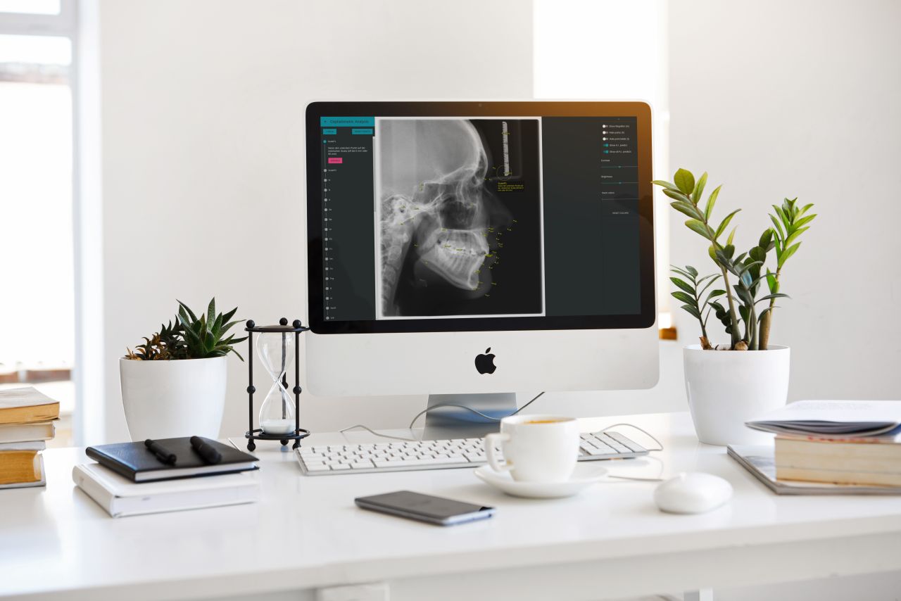 CellmatiQ Braces Orthodontists with AI NVIDIA Blog