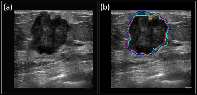 Mayo Clinic ultrasound deep learning research