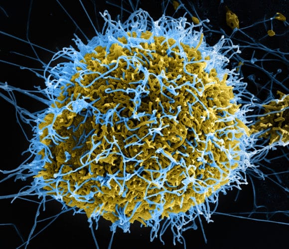 Ebola virus particles (in blue) in a colorized image from a scanning electron microscope. Atomwise found what may turn into new medications for the deadly disease. Image courtesy of the National Institute of Allergy and Infectious Diseases.