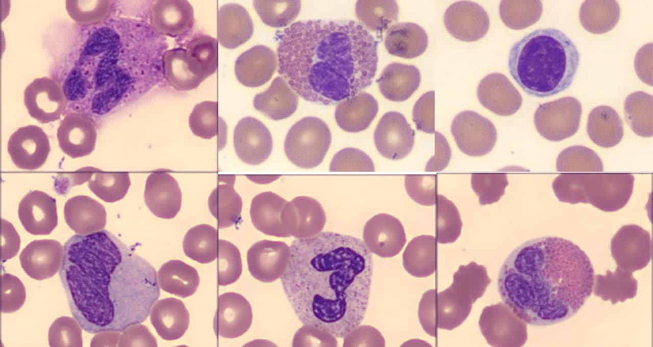 blood cell analysis