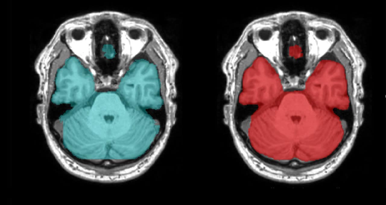 medical imaging at GTC Digital