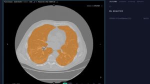Taking AI to Market: NVIDIA and Arterys Bridge Gap Between Medical Researchers and Clinicians