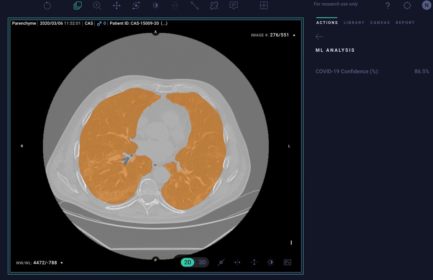 Taking AI to Market: NVIDIA and Arterys Bridge Gap Between Medical Researchers and Clinicians