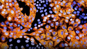 Here’s What Healthcare AI, Medical Device Companies Announced at GTC