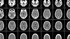 The Man With 100,000 Brains: AI’s Big Donation to Science