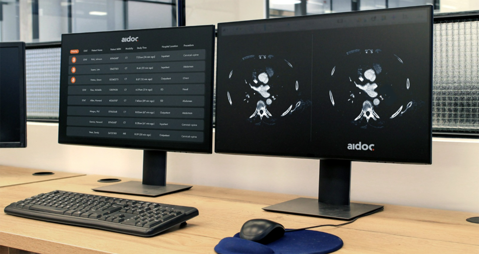 Aidoc's AI system