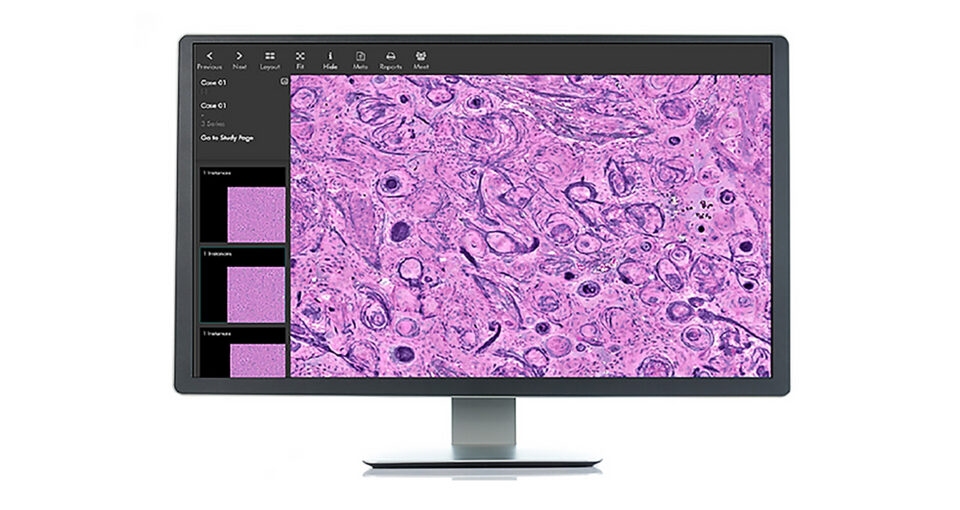 computer display with invenio imaging pathology interface