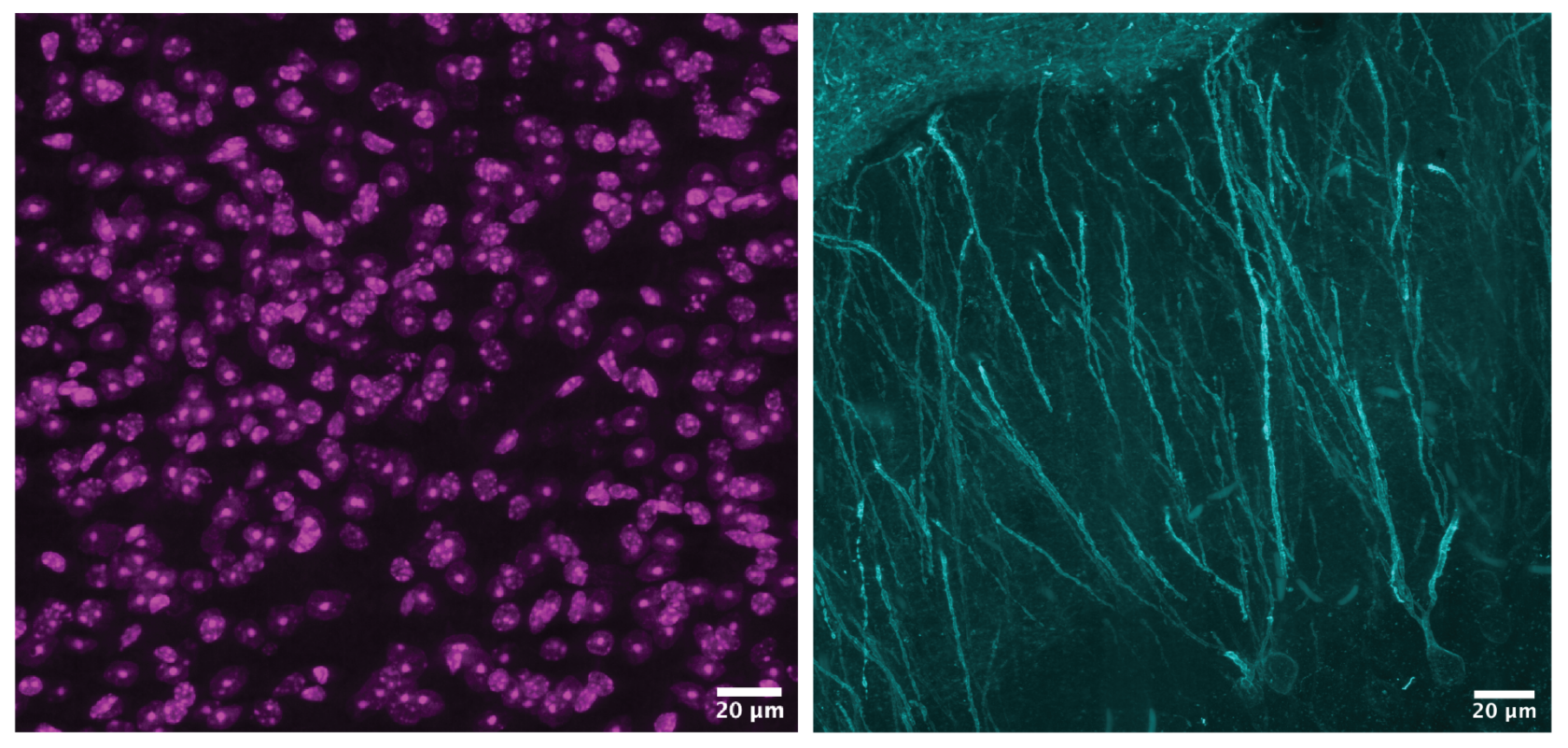 Two projection images of a neuronal cell nuclei (left) and dendrites (right) or branched extensions of a nerve cell. 
